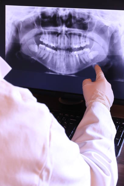Best Emergency Treatment for Dental Infections or Abscesses in Lakeville, MN