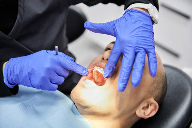 Best Emergency Dental Care for Broken or Chipped Teeth in Lakeville, MN